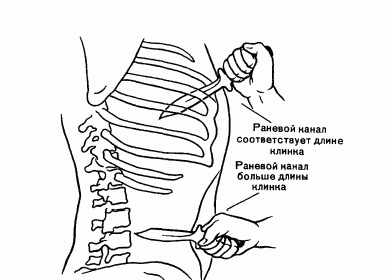 Рефераты | Рефераты по безопасности жизнедеятельности | Повреждения, причиняемые острыми предметами