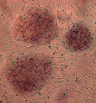 Рефераты | Рефераты по медицине | Эмбриональные стволовые клетки человека